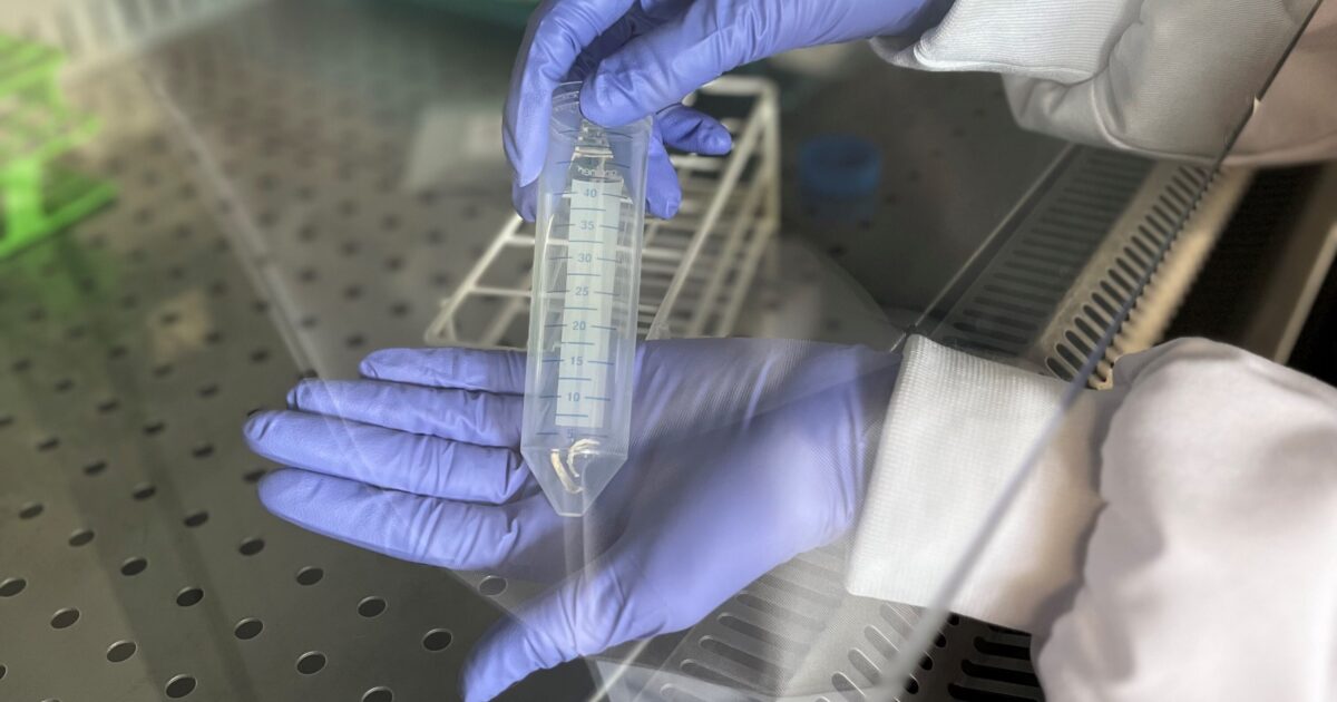 OpenGraph Image for Researchers hope toenails could identify causes of blood cancer