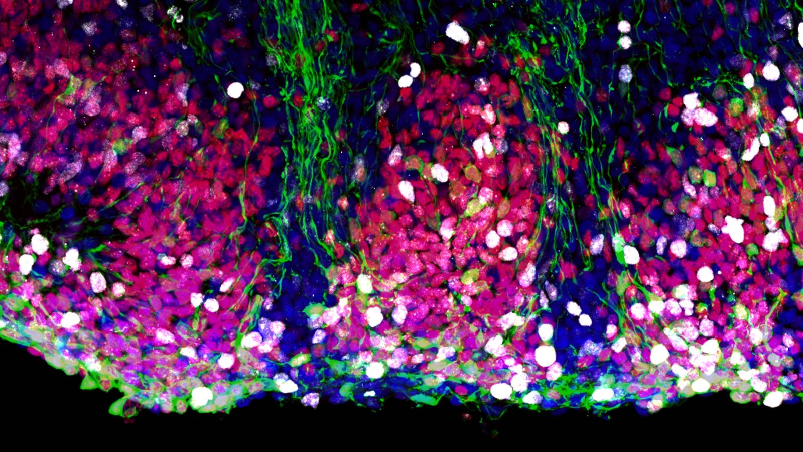 Microscope image showing neural stem cells within the new 3D ‘cerebroid’ model of the developing human brain