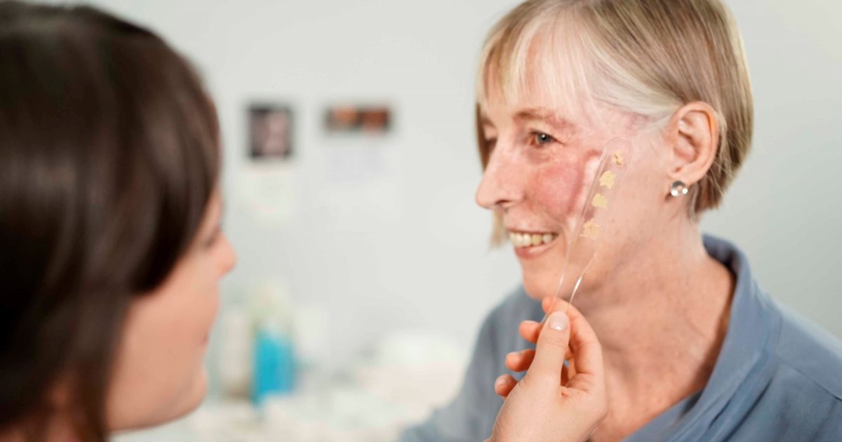 OpenGraph Image for Changing Faces and Clan Cancer Support partner to provide new skin camouflage service in Aberdeen
